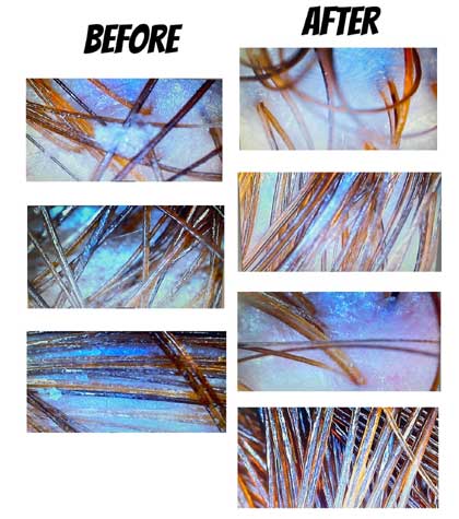 Japanese Head Spa at Bliss Beauty Care Portsmouth japanese head spa